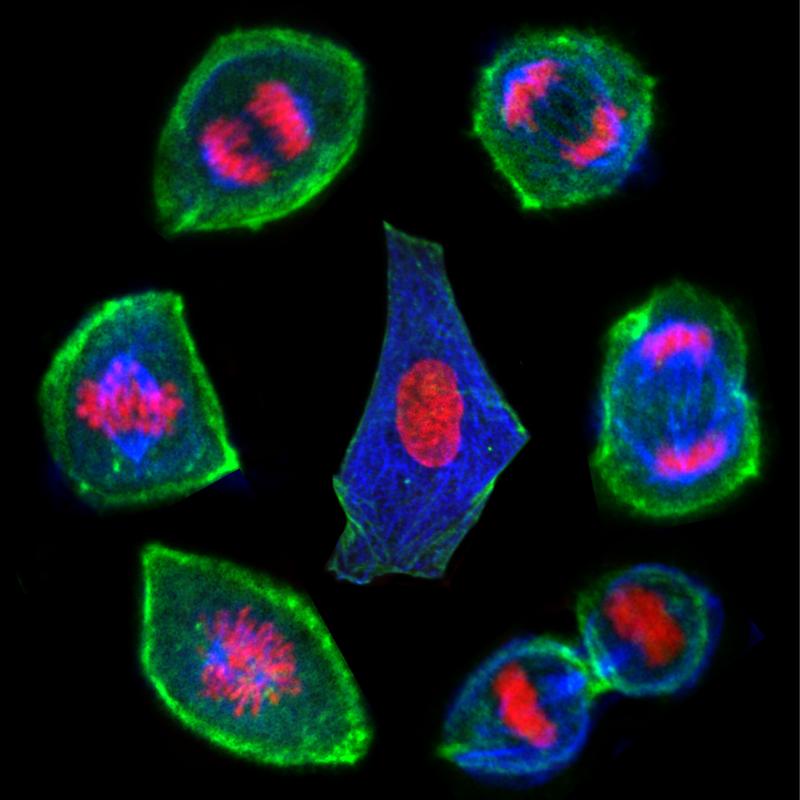 Von unten links im Uhrzeigersinn: Die Zellen werden runder und die Hülle wird dicker, während sich das Innere der Zelle verändert – es wird weicher und flüssiger. Das genetische Material wird aufgeteilt, so dass zwei neue Tochterzellen entstehen.