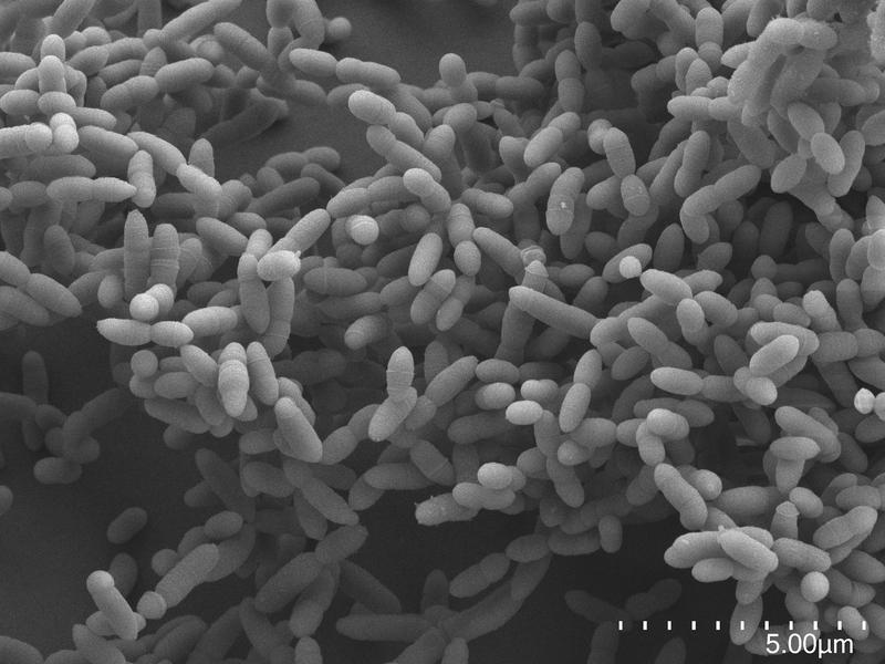 View of an archea colony in the scanning electron microscope.