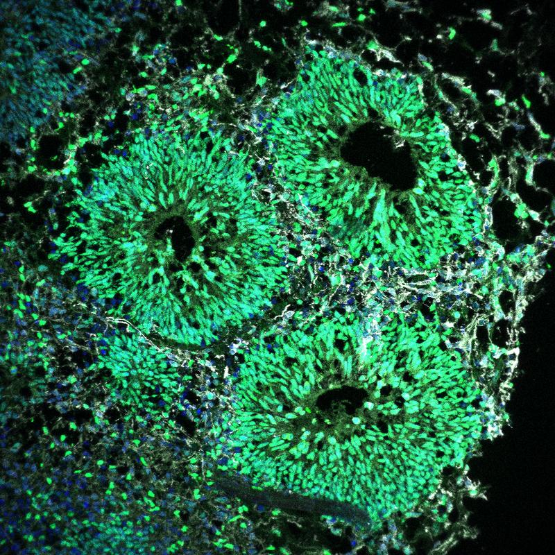 Human cerebral organoid showing ventricles composed of neural progenitor cells in green and newborn neurons in grey