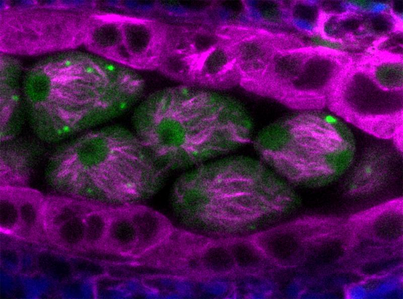 Querschnitt durch einen Staubbeutel von Arabidopsis thaliana mit fünf Meiozyten im Zentrum. Die grünen Punkte sind ‚stress granules‘, die bei Temperaturen über 30°C gebildet werden. Sie sind ein Zeichen dafür, dass die Pflanzen Temperaturstress wahrnehmen