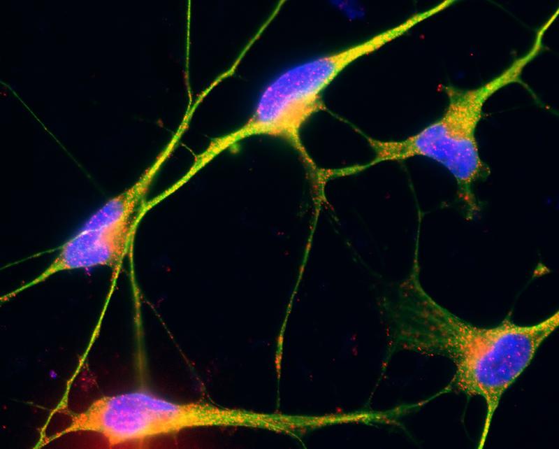 Aus induzierbaren pluripoenten Stammzellen differenzierte nozizeptive Nervenzellen. 
