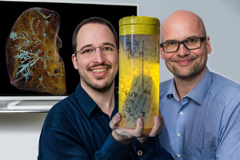 Professor Dr. Danny Jonigk (rechts) und Christopher Werlein mit dem linken Oberlappen eines COVID-19-Verstorbenen in einem für die Messung im HiP-CT geeigneten Spezialbehälter.