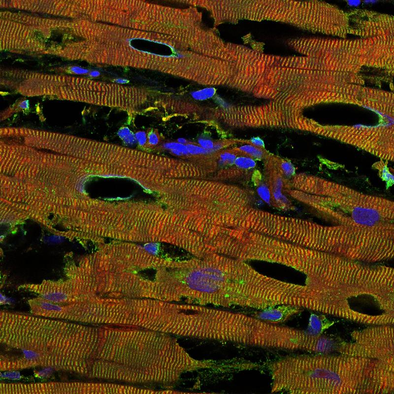 Heart tissue from a patient with chronic heart disease due to dilated cardiomyopathy. Red staining indicates titin, green another protein of the contractile units, and blue the nuclei. The holes are indicative of disease-induced tissue damage. 