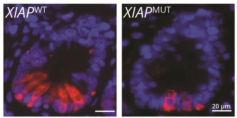 Dünndarmkrypten von CED-Patienten mit unverändertem (links) und mutiertem (rechts) XIAP-Gen. Die Paneth-Zellen sind rot und die Zellkerne aller Zellen in einer Krypta blau markiert.