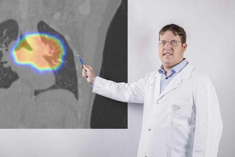 Dominic Leiser, der behandelnde Radioonkologe der ersten Patientin, die am PSI im Rahmen der Studie betreut wird. Er zeigt auf die computertomografische Aufnahme eines Lungenkarzinoms. Das farblich hervorgehobene Gebiet wird vom Protonenstrahl abgetastet.