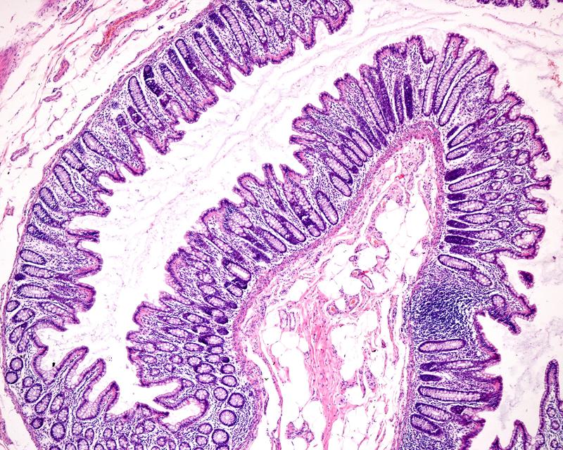 Curvature of cells in intestines. The curved tissue of the intestine walls maximizes the surface for the absorption of nutrients. 
