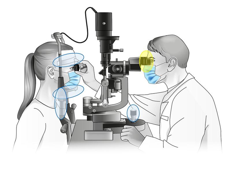 Slit lamp with marked sampling sites of the study (Fritz B. et al. (2021). Comprehensive Compositional Analysis of the Slit Lamp Bacteriota. Front. Cell. Infect. Microbiol. 11:745653).