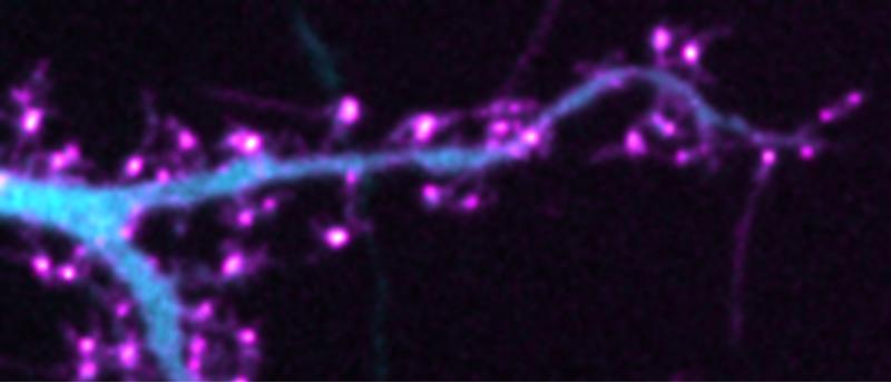  Fluoreszenzbild von lebenden Neuronen, die ein fluoreszierendes Protein (Cyan) und ein über Click-Chemie-markiertes Hilfsprotein TARP (Magenta) co-exprimieren.