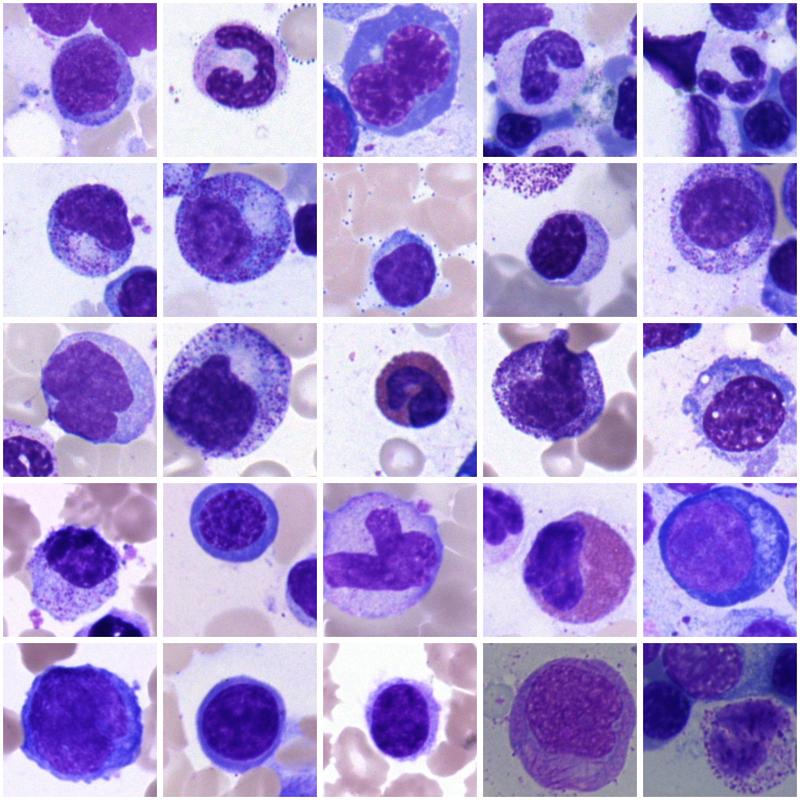 Künstliche Intelligenz erlaubt es, Knochenmarkszellen wie die hier abgebildeten automatisch zu klassifizieren, was einen wesentlichen Schritt zur Diagnostik von Erkrankungen des blutbildenden Systems darstellt. 