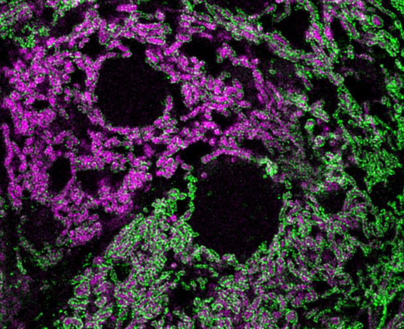 Die Abbildung zeigt Hepatozyten der Maus, in denen der Prozess der mitochondrialen Translation innerhalb der von der Mitochondrienmembran (grün) umschlossenen Mitochondrienmatrix sichtbar ist (magenta).