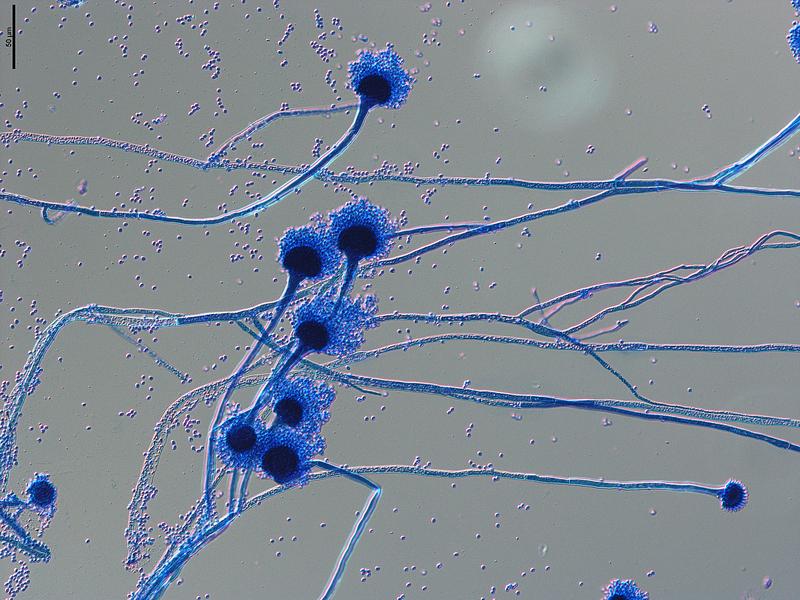 Sporenträger von Aspergillus fumigatus. Die als Konidien bezeichneten Sporen werden über die Luft verbreitet und gelangen leicht in unsere Atemwege, wo sie bei immungeschwächten Personen schwere Infektionen auslösen können.