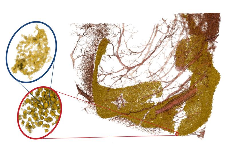 Das Bild zeigt neuronale Zellkerne der sogenannten Dentus gyratus (gelb) und dazu gehörige Blutgefäße (rot). Durch unterschiedliche Vergrößerung der Röntgenoptik kann man in das dicht gepackte Band von Neuronen "reinzoomen".