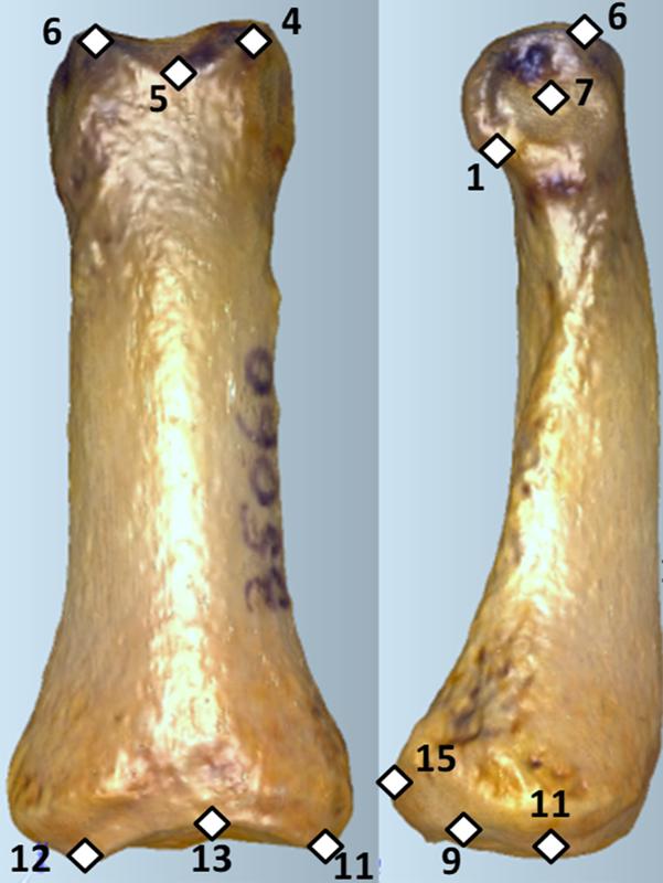 Digitale "Landmarks", Orientierungspunkte auf dreidimensionalen Computermodellen eines Fingerknochens