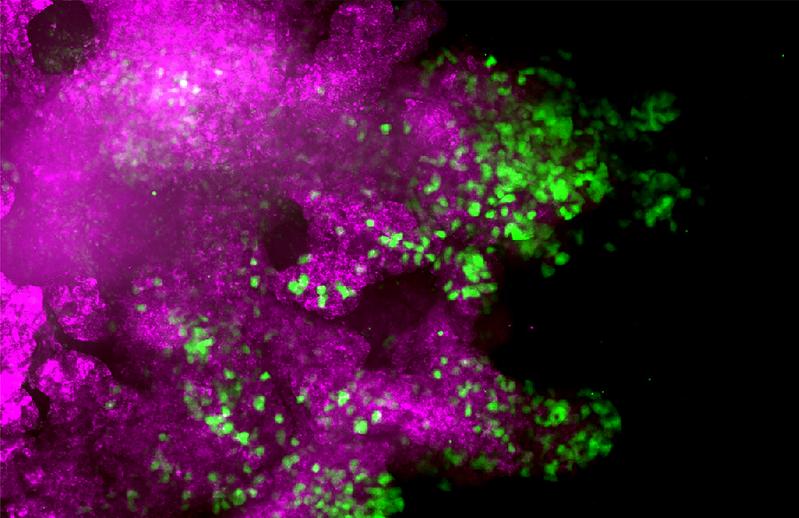 Malignant breast cancer cells that have undergone partial EMT (green) leave the original cell cluster (red) and migrate to the surrounding area.