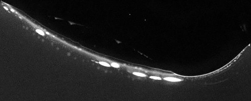 Fluorescence microscopy image of protocells in contact with a gas bubble. Coacervate assemblies are a valid model to mimic the first protocells that arose on Early Earth and to study how the first steps of life could have evolved. 