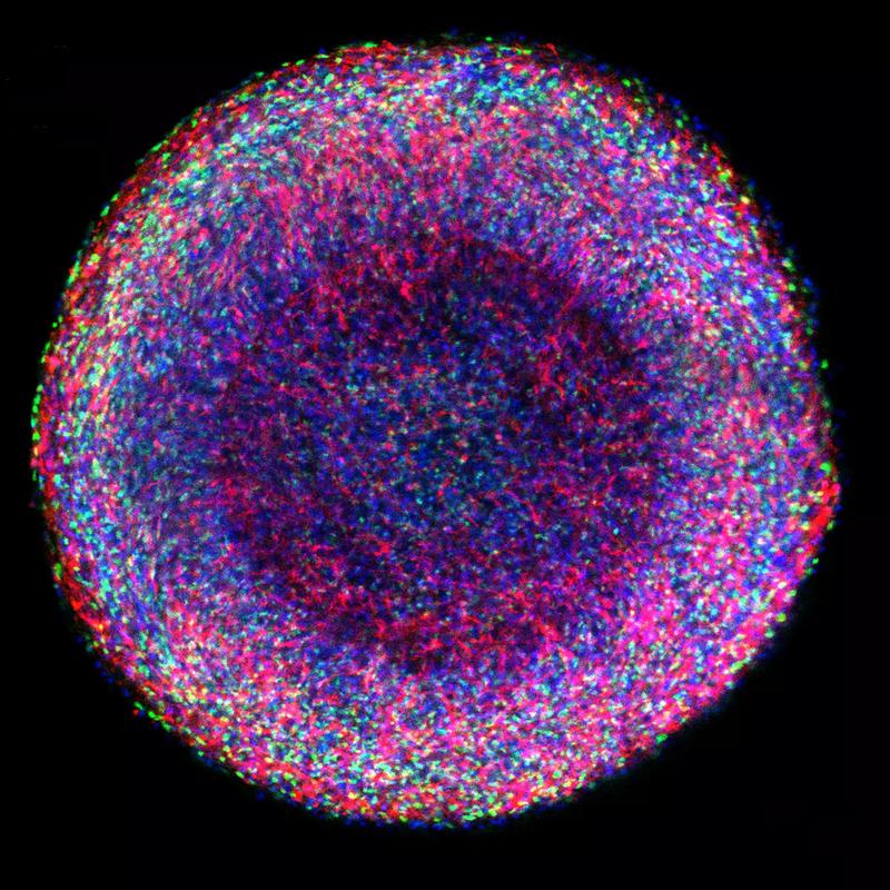 Optischer Schnitt durch ein Mittelhirnorganoid nach 25 Tagen robotischer Maturierung zeigt verschiedene typische Zelltypen: blau: Zellkerne; rot: Dopamin-produzierende Neurone; grün: neurale Vorläuferzellen.