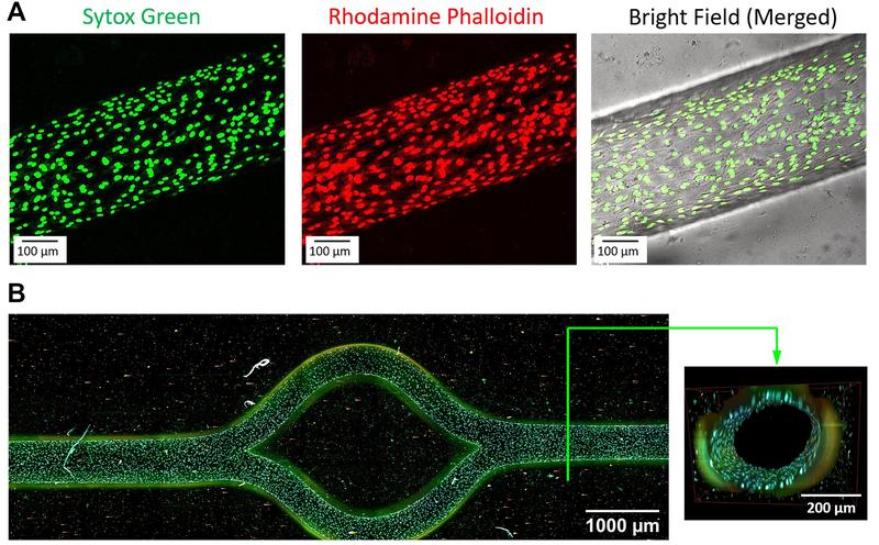 3D-gedrucktes Blutgefäß mit unterschiedlich gefärbten Zellstrukturen und in Durchlicht-Mikroskopie (A). Aufsicht und Schnitt durch eine vollkommen mit Zellen besiedelte Gefäßschlinge zur Herstellung von durchbluteten Krebsmodellen (B).