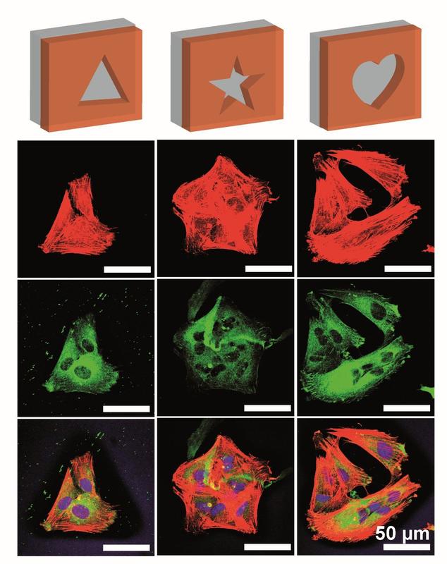 Laser-Scanning-Mikroskop-Aufnahmen von BJ-Fibroblasten auf verschieden strukturierten Filmen aus rekombinanter Spinnenseide. Rot: das F-Aktin-Zytoskelett, grün: das Protein Vinculin, blau: der von diesen Zellbestandteilen überlagerte Zellkern.