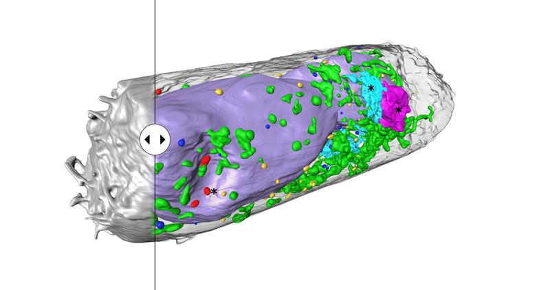 Human lung epithelium cell 24 hours after SARS-CoV-2 viral infection. Hijacked cellular organelles are labelled with an asterisk.