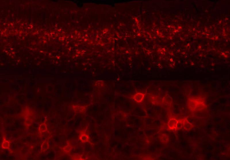 Neuronale Plastizität wird durch den enzymatischen Abbau der extrazellulären Matrix des Gehirns gefördert. Diese fluoreszenzmikroskopische Aufnahme zeigt Nervenzellen aus der Sehrinde einer Maus, die von rot markierten ECM Molekülen umhüllt sind.