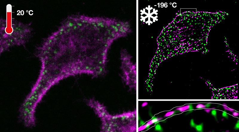 Links: Fluoreszenzmikroskopie eines Onkoproteins und des entsprechenden Tumorsuppressors in einer lebenden Zelle vor der Kryo-Arretierung. Rechts: Bild derselben Zelle mit Superauflösender Mikroskopie während der Kryo-Arretierung.