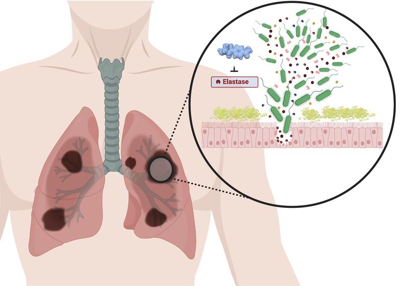 Die entwickelten Pathoblocker inaktivieren das Enzym LasB und entwaffnen somit den Krankheitserreger Pseudomonas aeruginosa.