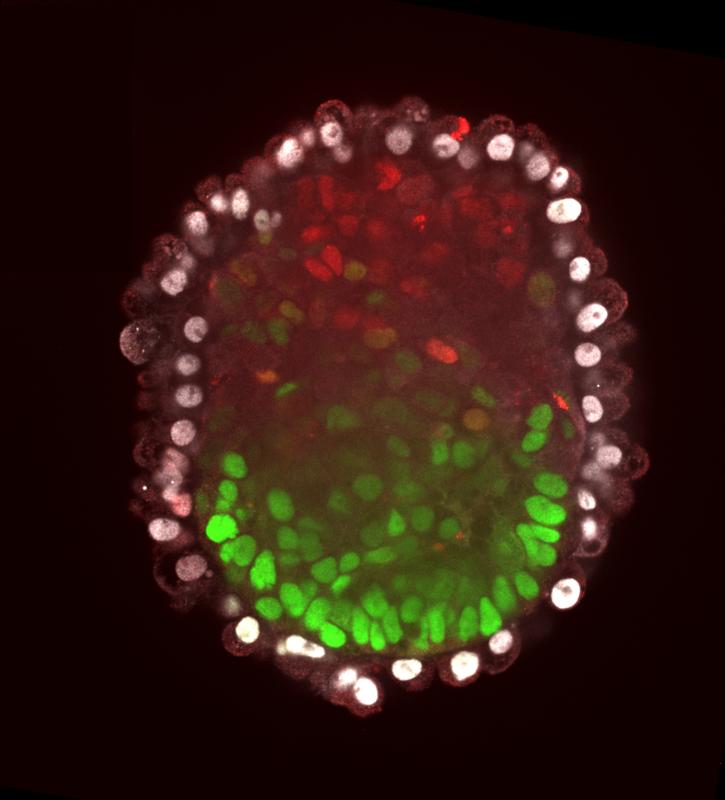 Embryoid nach Selbstorganisation: Die pluripotenten embryonalen Stammzellen der Maus sind grün gefärbt, in den rot gefärbten Zellen ist das Plazenta-Programm und in den grau gefärbte Zellen das Membran-Programm aktiv. 