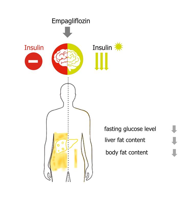 The diabetes drug empagliflozin normalizes insulin action in the brain, improves fasting glucose levels, lowers liver fat and reduces body fat.