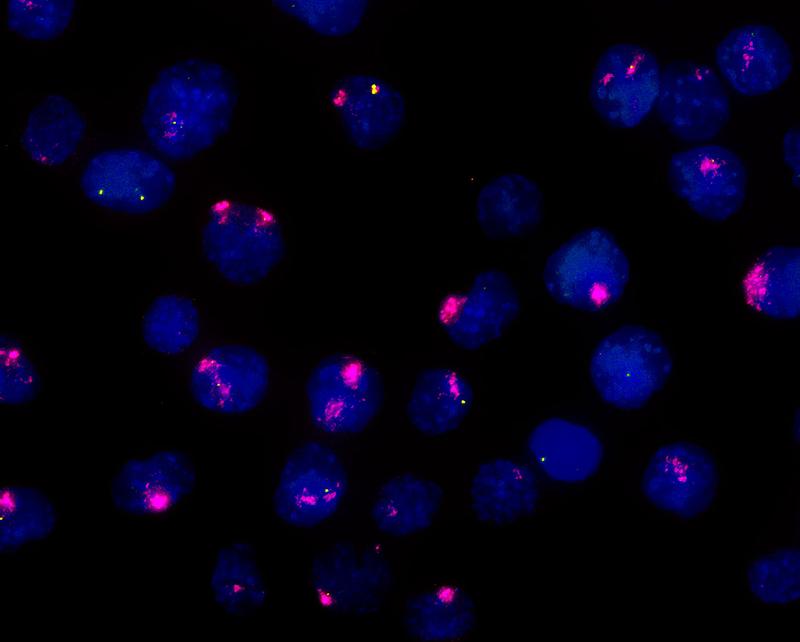 Eines von zwei X-Chromosomen wird in den Zellkernen weiblicher Stammzellen der Maus inaktivert: Das Xist-Gen produziert RNA-Kopien (pink), angetrieben auch durch eine kleine X-chromosomale Region namens Xert (gelb). Die DNA der Zellen ist blau gefärbt.