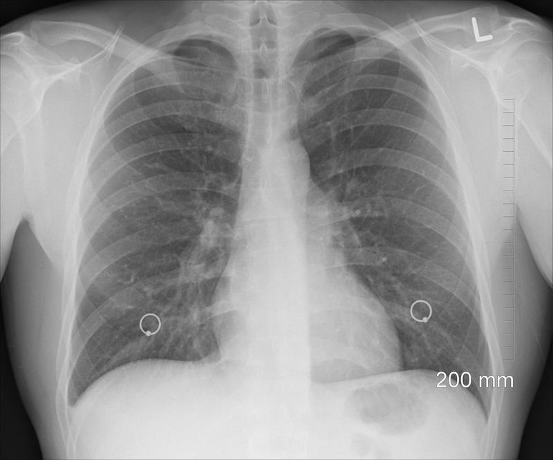 Künstliche Intelligenz kann bei der medizinischen Diagnosestellung helfen