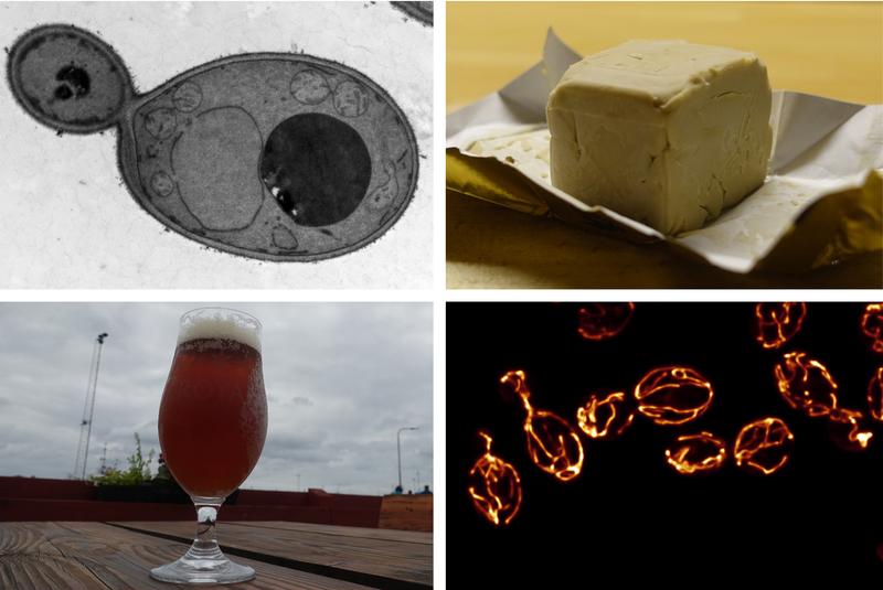 Microbe of the Year 2022, Saccharomyces cerevisiae (electron microscope, top left and bottom right), used as baker's yeast and its product beer, photographs: Benedikt Westermann, Christina Schug, Till Klecker, Bayreuth (CC BY 4.0)