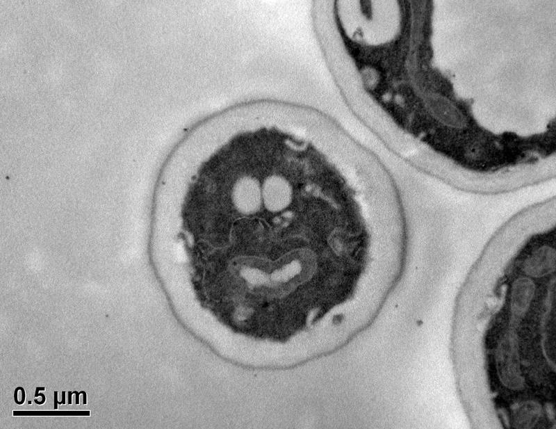 Die Mikrobe des Jahres 2022, Saccharomyces cerevisiae, 20.000fach vergrößert, Aufnahme: Mara Reifenrath, Frankfurt am Main (CC BY 4.0).