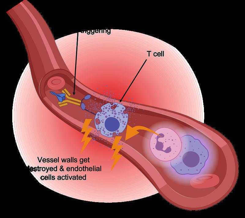 The fatal role of T-cells in COVID-19