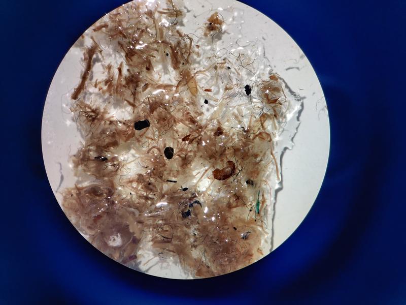 Suspected microplastic fibres > 500 μm partially extracted from a sludge-applied soil sample. Artificial fibres can be seen amongst plant matter. Fibres are extracted and analysed using FT-IR to determine whether they are plastic.
