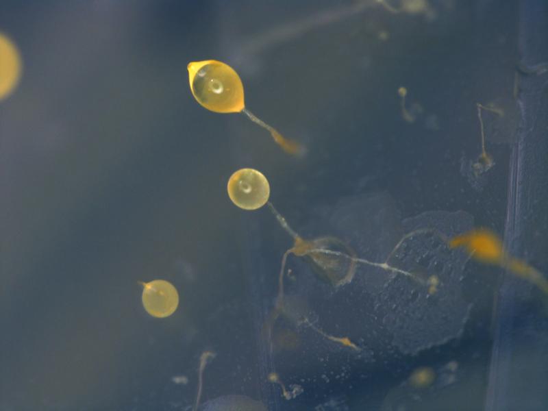 Die einzellige Amöbe Dictyostelium discoideum kann sich zu einem vielzelligen Verband zusammenschließen und Fruchtkörper ausbilden, die Sporen produzieren.