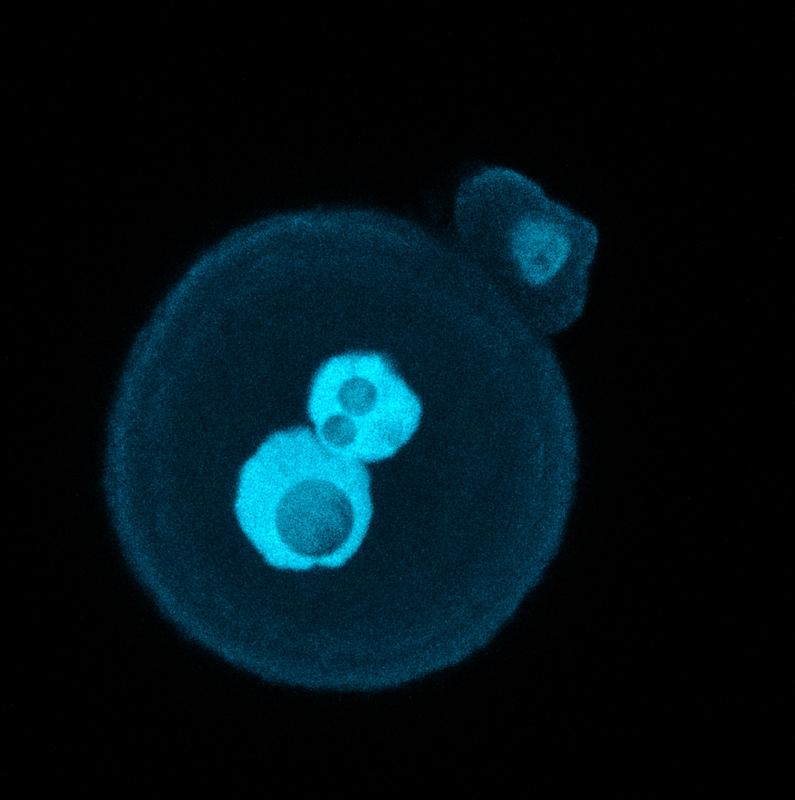 The zygote of a mouse stained with fluorescent dyes, with the nuclei of the sperm and egg cells still visible as bright blobs in the middle
