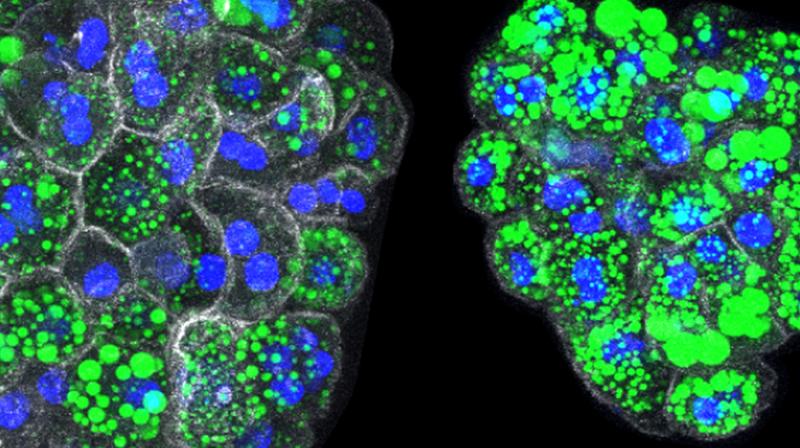 Leber-Organoide normaler (links) und mutierter (rechts) Mäuse. Ansammlung von Lipiden in grün sichtbar. Die höheren Lipidmengen sammeln sich  als Tröpfchen im Inneren jeder Zelle an (Zellkerne in Blau und umgebende Zellmembran in Weiß).