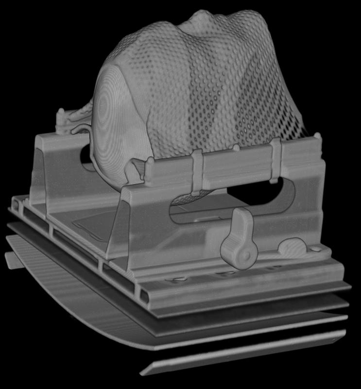 Individueller Patientenplan, übertragen auf 3D-gedruckten Schädel. 3D-Rekonstruktion auf Basis einer Computertomografischen Aufnahme.