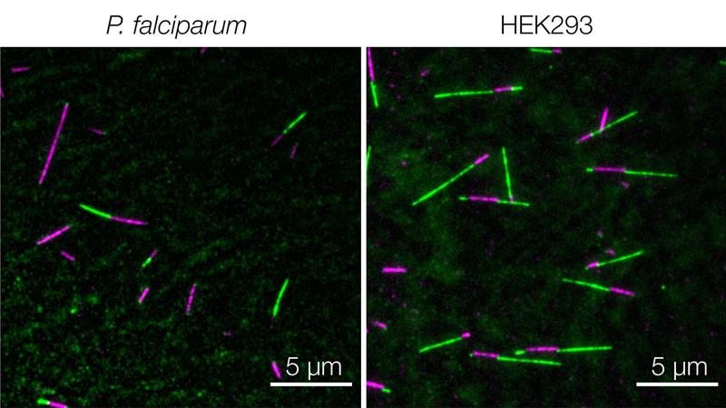Dynamic microtubules can be visualised using total internal reflection fluorescence (TIRF) microscopy, which can be used to characterise differences between parasite (l) and mammalian HEK293 (r) tubulin. 