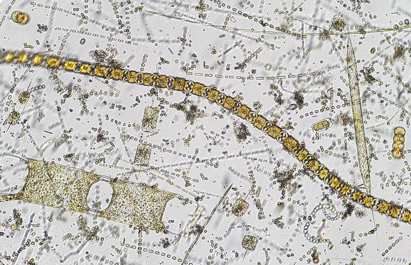 Die Zellgröße vieler Diatomeen, ähnlich denen auf diesem Bild, hat sich im Wattenmeer in den vergangenen Jahren deutlich verringert. 