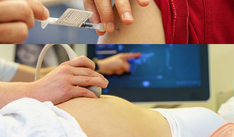 Warum Schwangere sich gegen Covid impfen lassen sollten