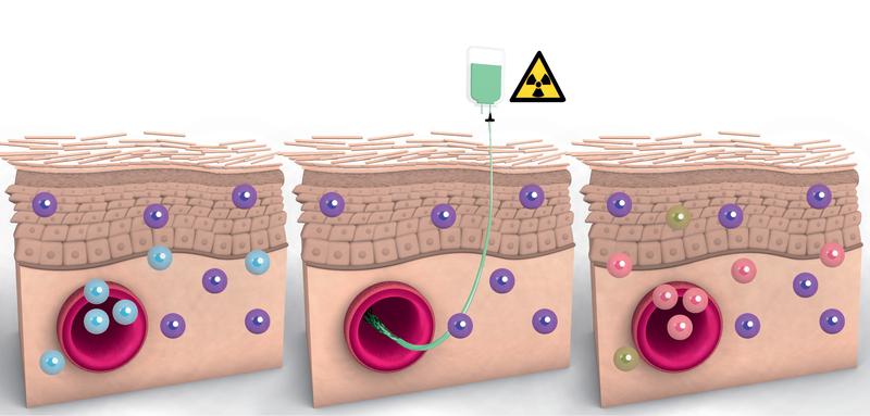 Resident T cells (purple) survive radiation and chemotherapy in some patients. Donor cells (pink and green) are thus primarily found in the bloodstream.