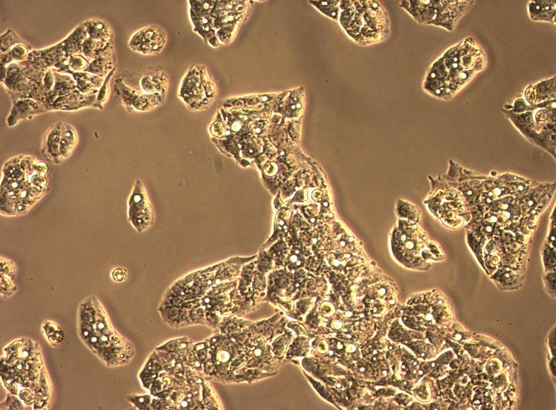 Eines der hauptsächlich in dem Nitrosamin-Forschungsprojekt verwendeten In-vitro-Modellsysteme ist die humane Leberzelllinie HepG2.