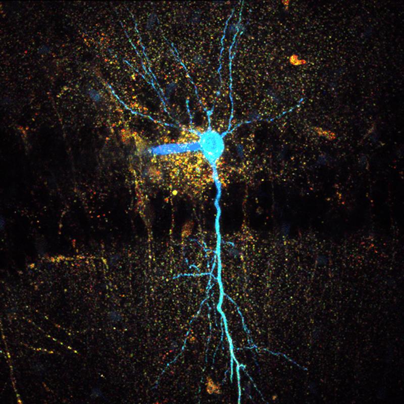 Microscopic fluorescence lifetime image of a CA1 pyramidal neuron in the hippocampus of a mouse. The neuron was filled with the sodium-sensitive indicator ING-2 using a so-called patch pipette. 