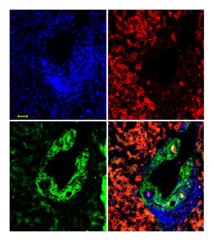 Stained liver tissue shows the complementary occurrence of pVHL and SMAD proteins: Where pVHL (green) is abundant, SMAD2/3 (red) is scarce, and vice versa. Cell nuclei are stained blue. The lower right picture shows all three colours combined.