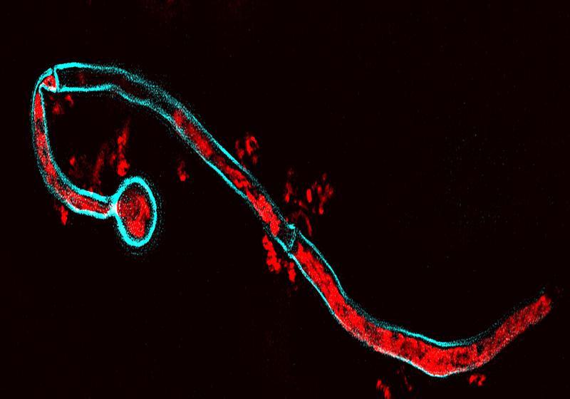 Candida albicans (blau) nimmt menschliche microRNA (rot) aus extrazellulären Vesikeln auf.