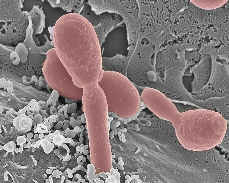 Human immune cells secrete vesicles in response to infection with Candida albicans.