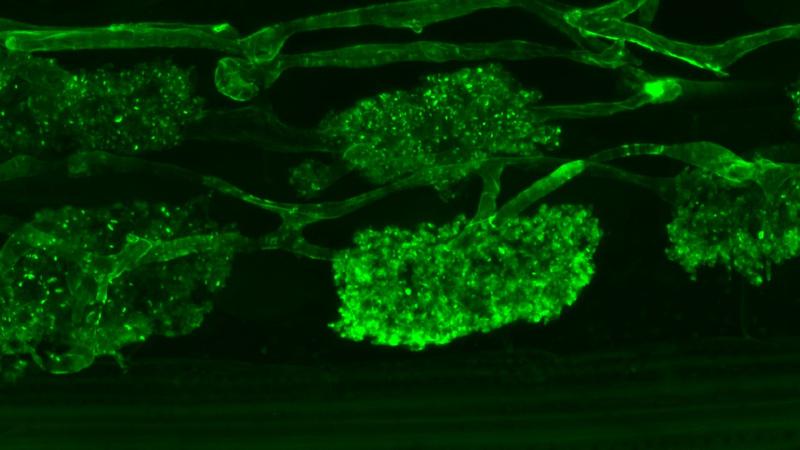 Bäumchenförmige Arbuskeln eines arbuskulären Mykorrhizapilzes in einer Wurzel gefärbt mit einem Fluoreszenzfarbstoff.
