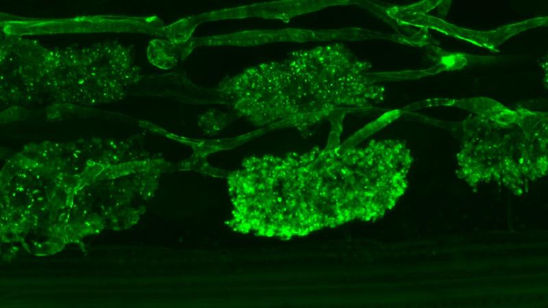 Tree-shaped arbuscules of an arbuscular mycorrhiza fungus in a root, stained with a fluorescent dye.