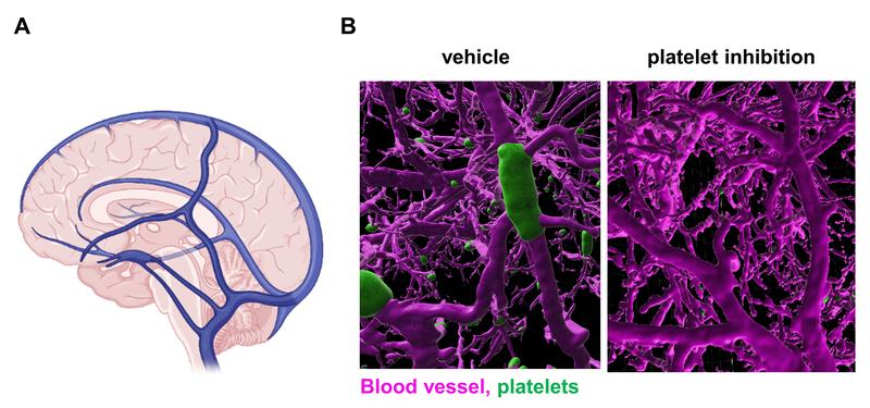 A) Schematic representation of the large cerebral veins. B) Modern microscopy techniques show clot formation in the cerebral veins of mice. On the left vessels from a diseased mouse, on the right images from mice whose platelets have been inhibited.